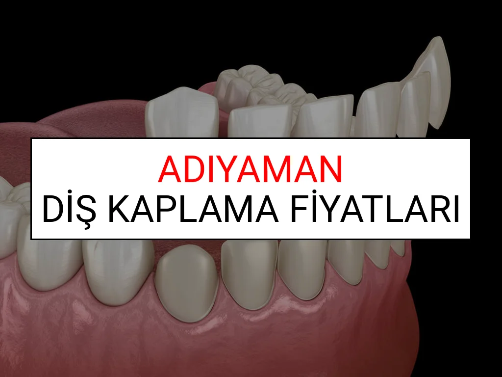 Adıyaman Diş Kaplama Fiyatları Ne Kadar? (2025 Adıyaman TDB Diş Kaplama Fiyatları)