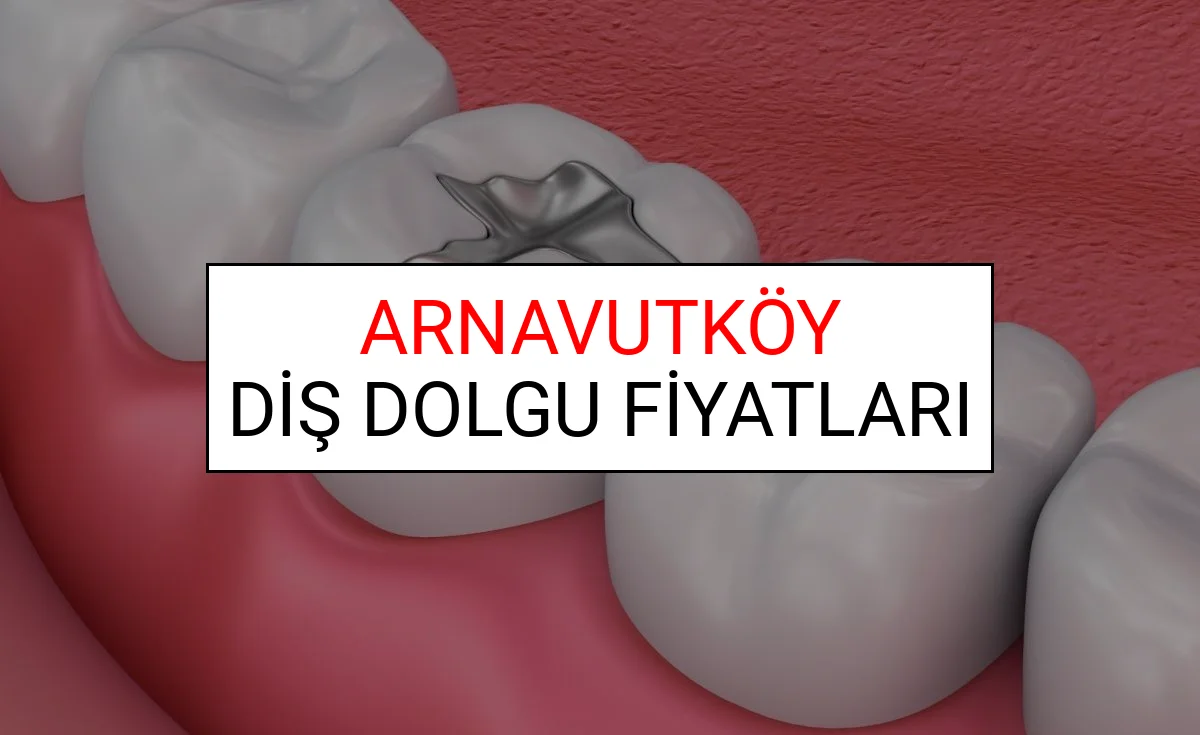 Arnavutköy Diş Dolgu Fiyatları Ne Kadar? (2025 TDB Arnavutköy Diş Dolgu Ücreti)