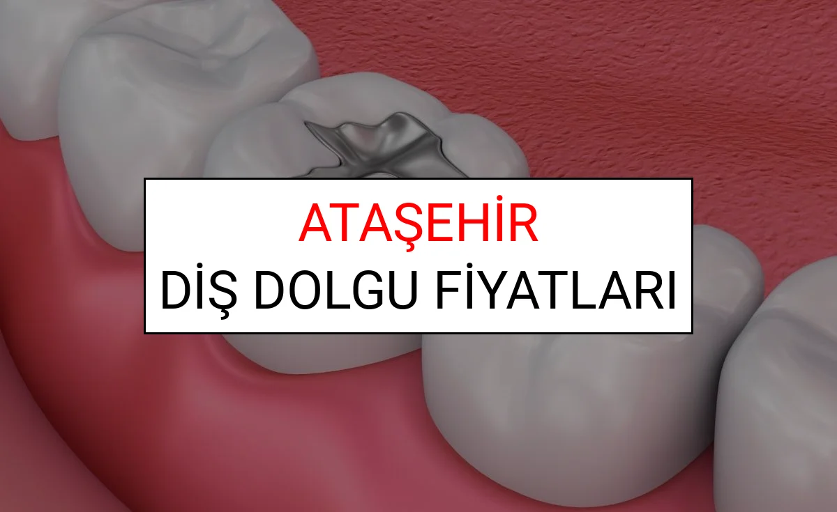 Ataşehir Diş Dolgu Fiyatları Ne Kadar? (2025 TDB Ataşehir Diş Dolgu Ücreti)