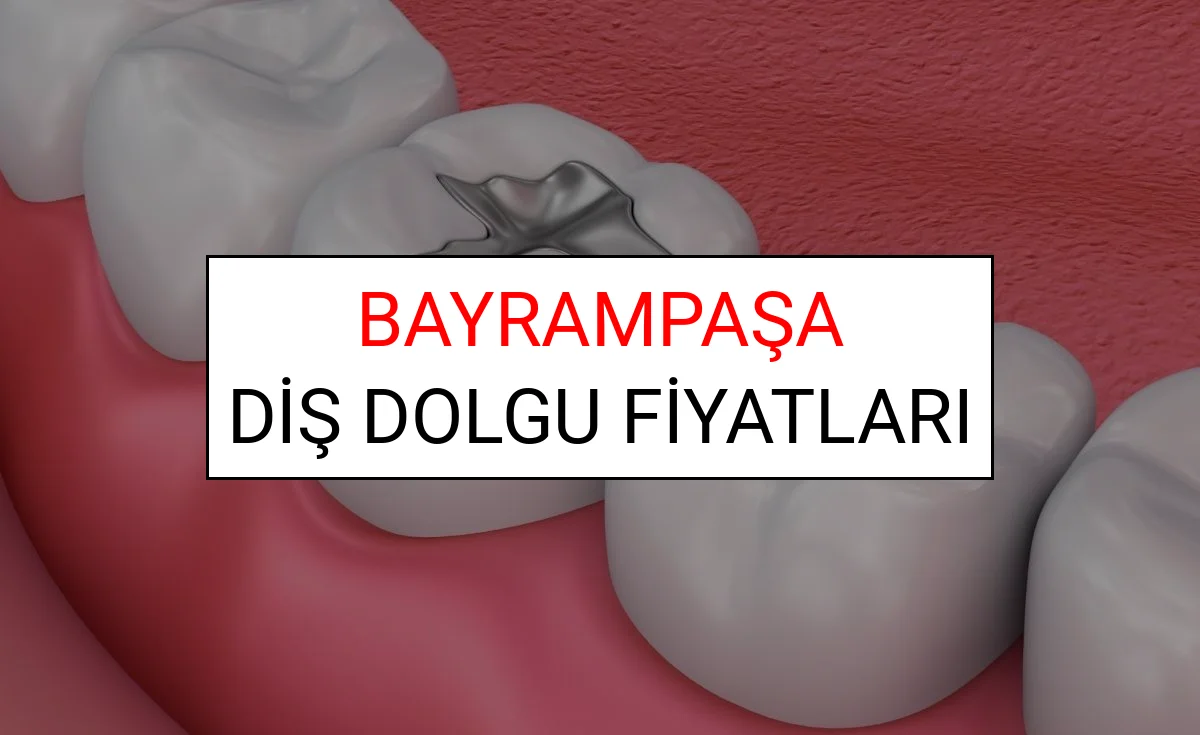 Bayrampaşa Diş Dolgu Fiyatları Ne Kadar? (2025 TDB Bayrampaşa Diş Dolgu Ücreti)