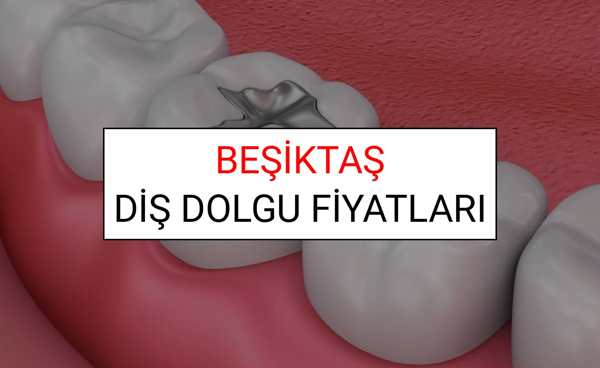 Beşiktaş Diş Dolgu Fiyatları Ne Kadar? (2025 TDB Beşiktaş Diş Dolgu Ücreti)