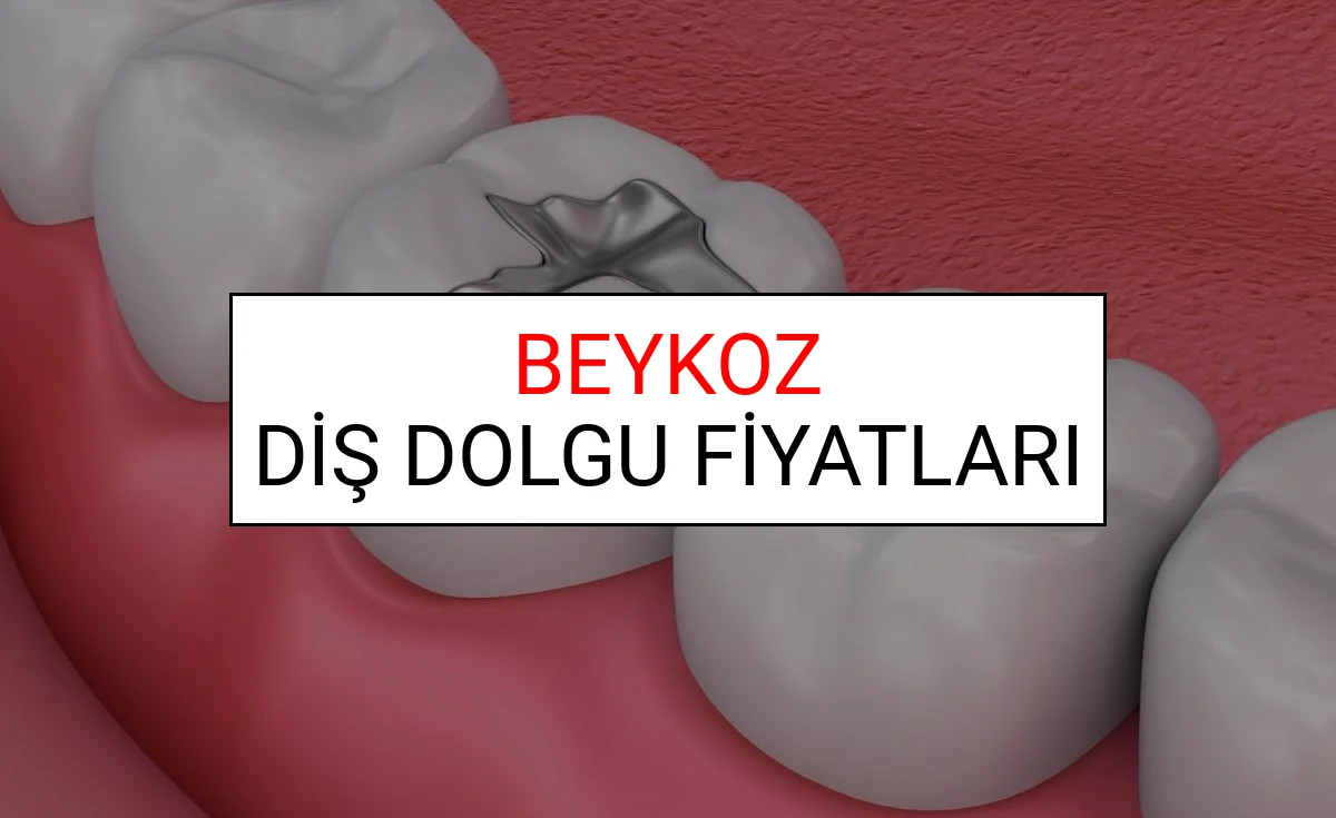 Beykoz Diş Dolgu Fiyatları Ne Kadar? (2025 TDB Beykoz Diş Dolgu Ücreti)