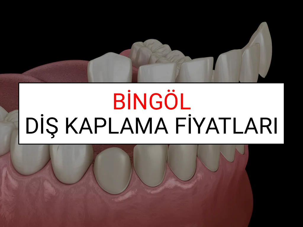 Bingöl Diş Kaplama Fiyatları Ne Kadar? (2025 Bingöl TDB Diş Kaplama Fiyatları)