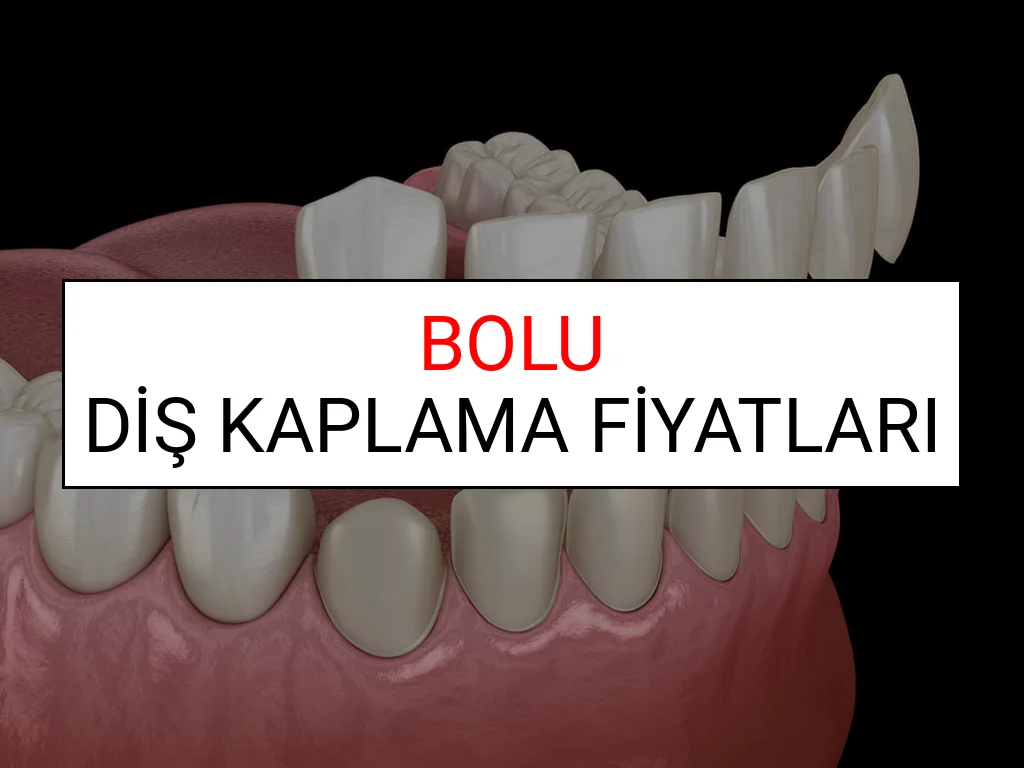 Bolu Diş Kaplama Fiyatları Ne Kadar? (2025 Bolu TDB Diş Kaplama Fiyatları)