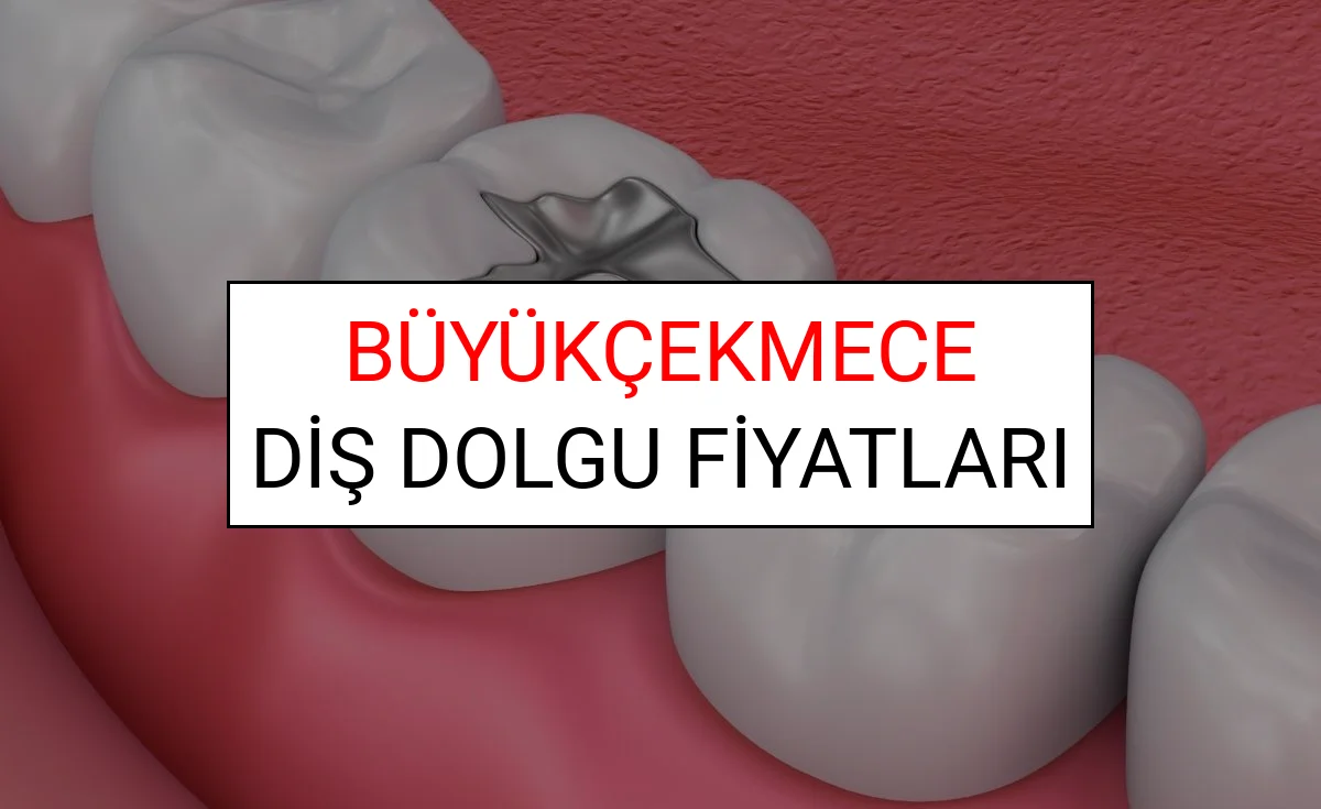 Büyükçekmece Diş Dolgu Fiyatları Ne Kadar? (2025 TDB Büyükçekmece Diş Dolgu Ücreti)