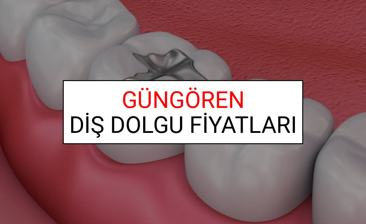 Güngören Diş Dolgu Fiyatları Ne Kadar? (2025 TDB Güngören Diş Dolgu Ücreti)