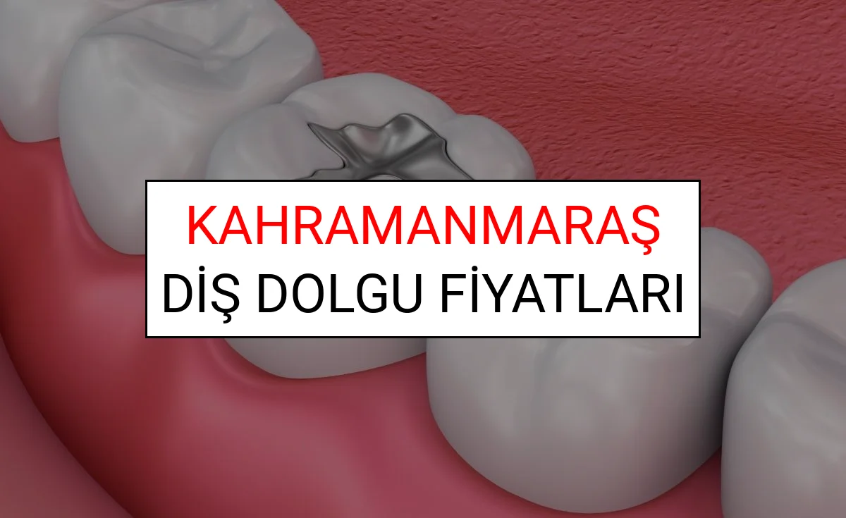 Kahramanmaraş Diş Dolgu Fiyatları Ne Kadar? (2025 TDB Kahramanmaraş Diş Dolgu Ücreti)