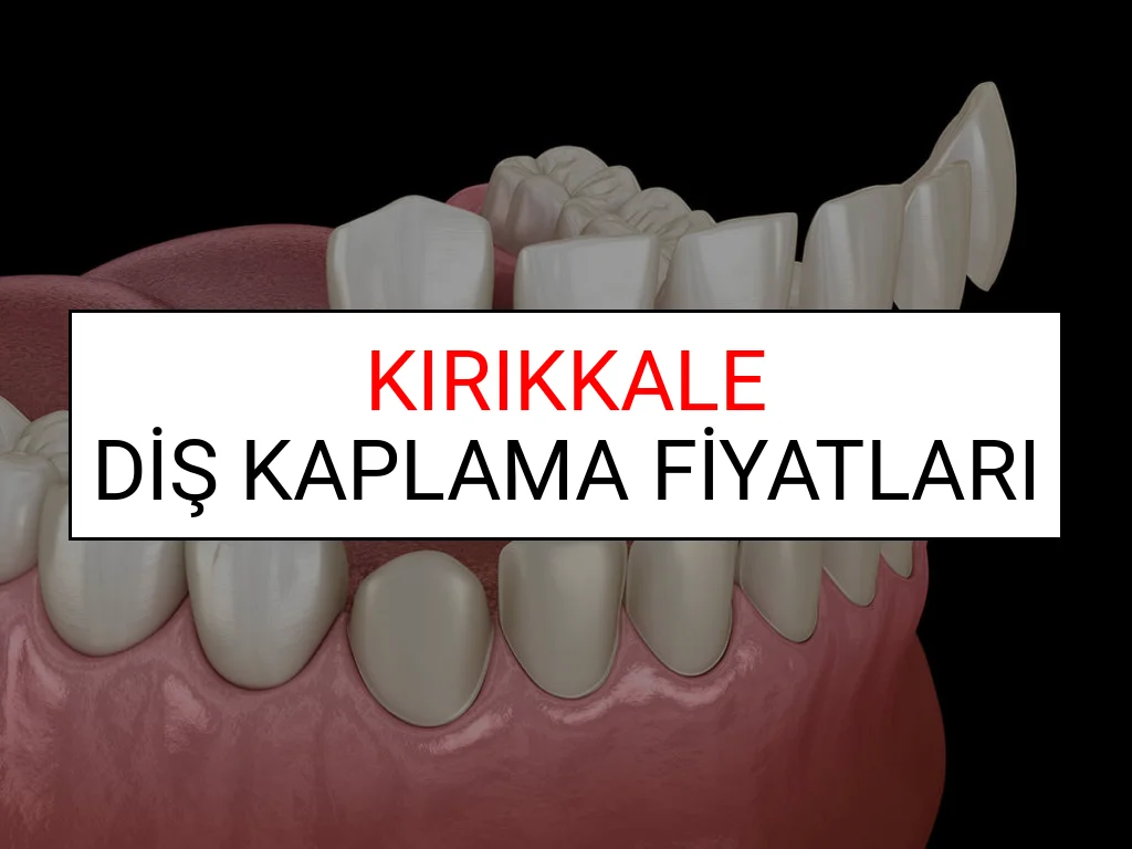 Kırıkkale Diş Kaplama Fiyatları Ne Kadar? (2025 Kırıkkale TDB Diş Kaplama Fiyatları)