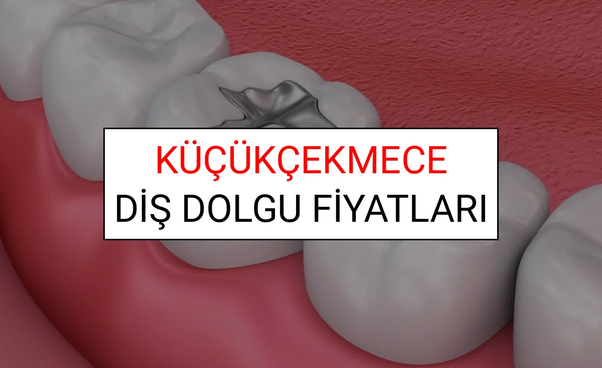 Küçükçekmece Diş Dolgu Fiyatları Ne Kadar? (2025 TDB Küçükçekmece Diş Dolgu Ücreti)