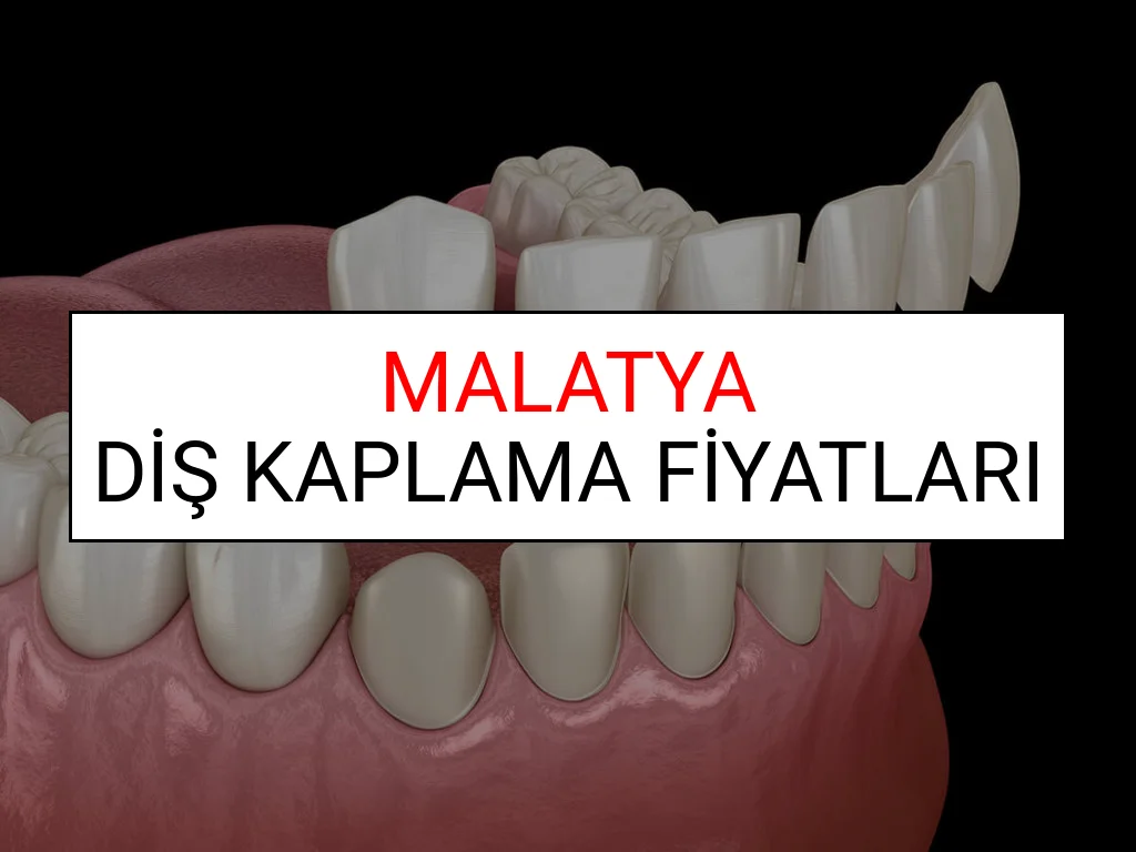 Malatya Diş Kaplama Fiyatları Ne Kadar? (2025 Malatya TDB Diş Kaplama Fiyatları)