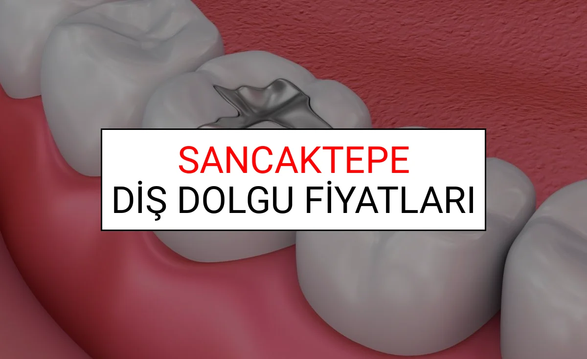 Sancaktepe Diş Dolgu Fiyatları Ne Kadar? (2025 TDB Sancaktepe Diş Dolgu Ücreti)