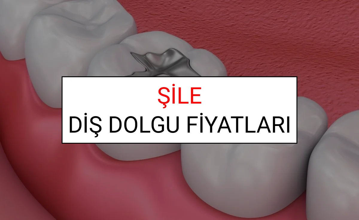 Şile Diş Dolgu Fiyatları Ne Kadar? (2025 TDB Şile Diş Dolgu Ücreti)