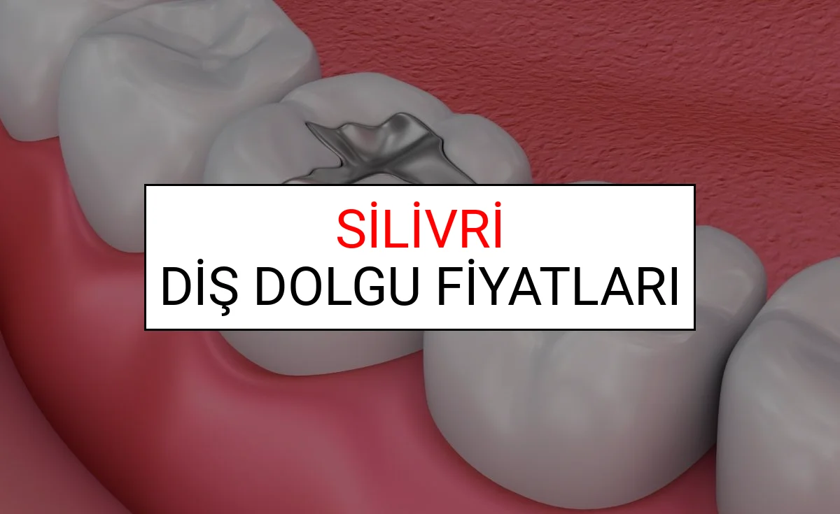 Silivri Diş Dolgu Fiyatları Ne Kadar? (2025 TDB Silivri Diş Dolgu Ücreti)