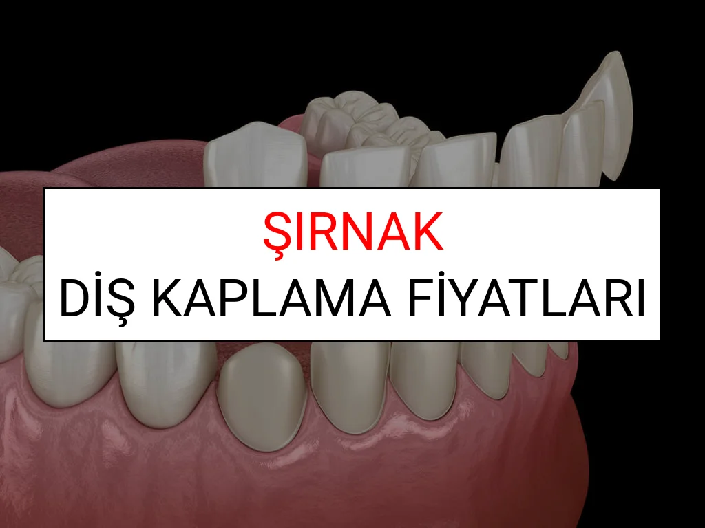 Şırnak Diş Kaplama Fiyatları Ne Kadar? (2025 Şırnak TDB Diş Kaplama Fiyatları)