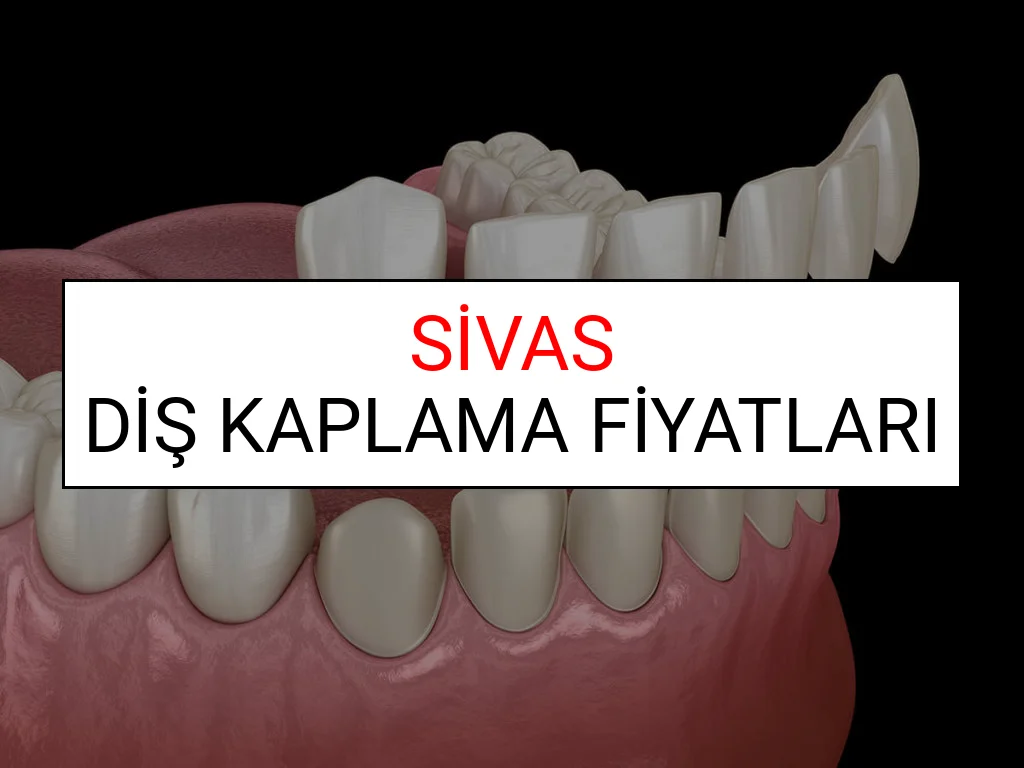 Sivas Diş Kaplama Fiyatları Ne Kadar? (2025 Sivas TDB Diş Kaplama Fiyatları)