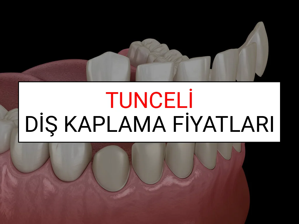 Tunceli Diş Kaplama Fiyatları Ne Kadar? (2025 Tunceli TDB Diş Kaplama Fiyatları)