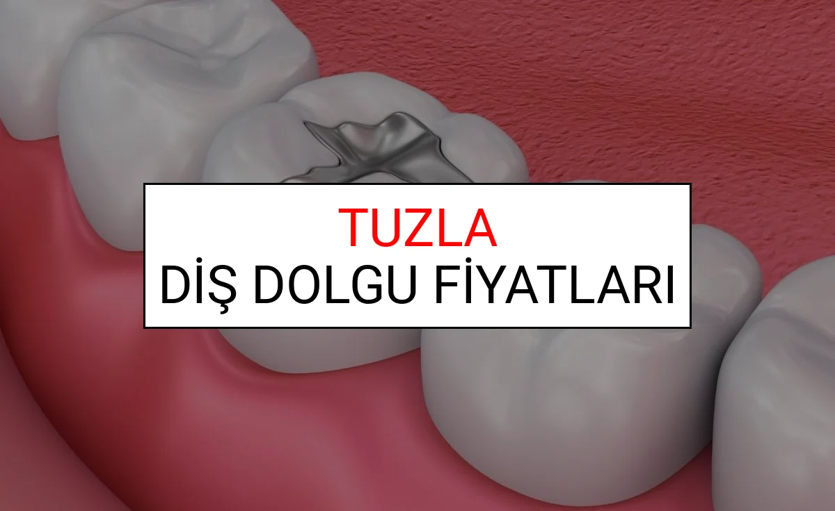 Tuzla Diş Dolgu Fiyatları Ne Kadar? (2025 TDB Tuzla Diş Dolgu Ücreti)