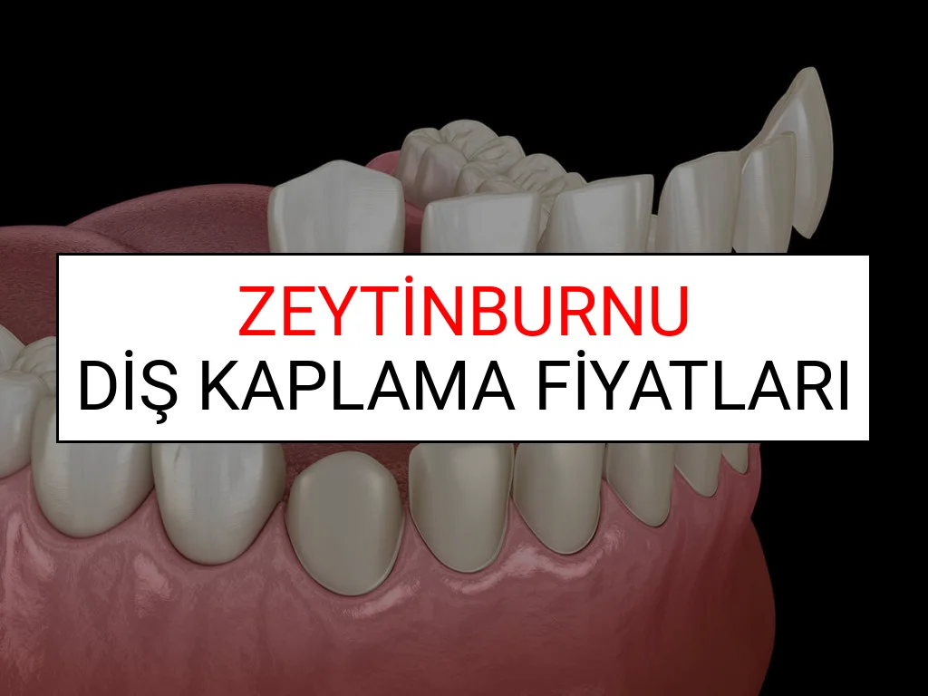 Zeytinburnu Diş Kaplama Fiyatları Ne Kadar? (2025 Zeytinburnu TDB Diş Kaplama Fiyatları)