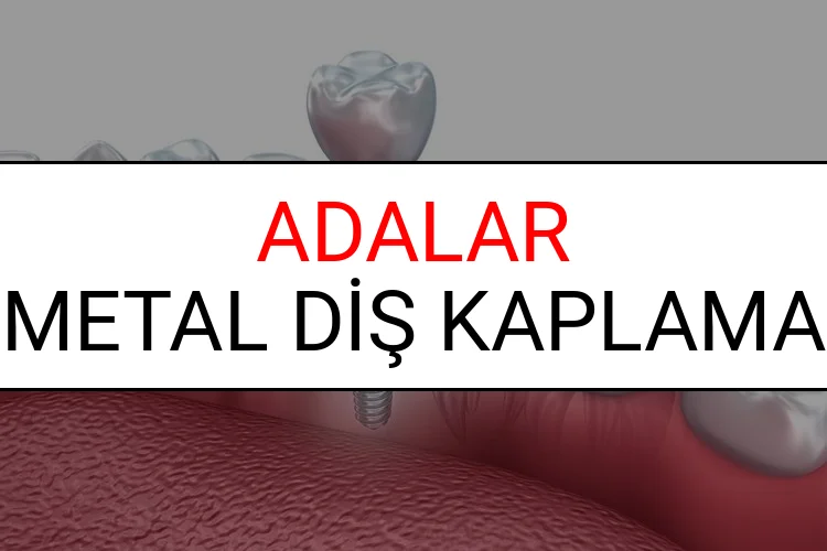 Adalar Metal Diş Kaplama Fiyatları Ne Kadar? (2025 Adalar TDB Metal Destekli Diş Fiyatları)