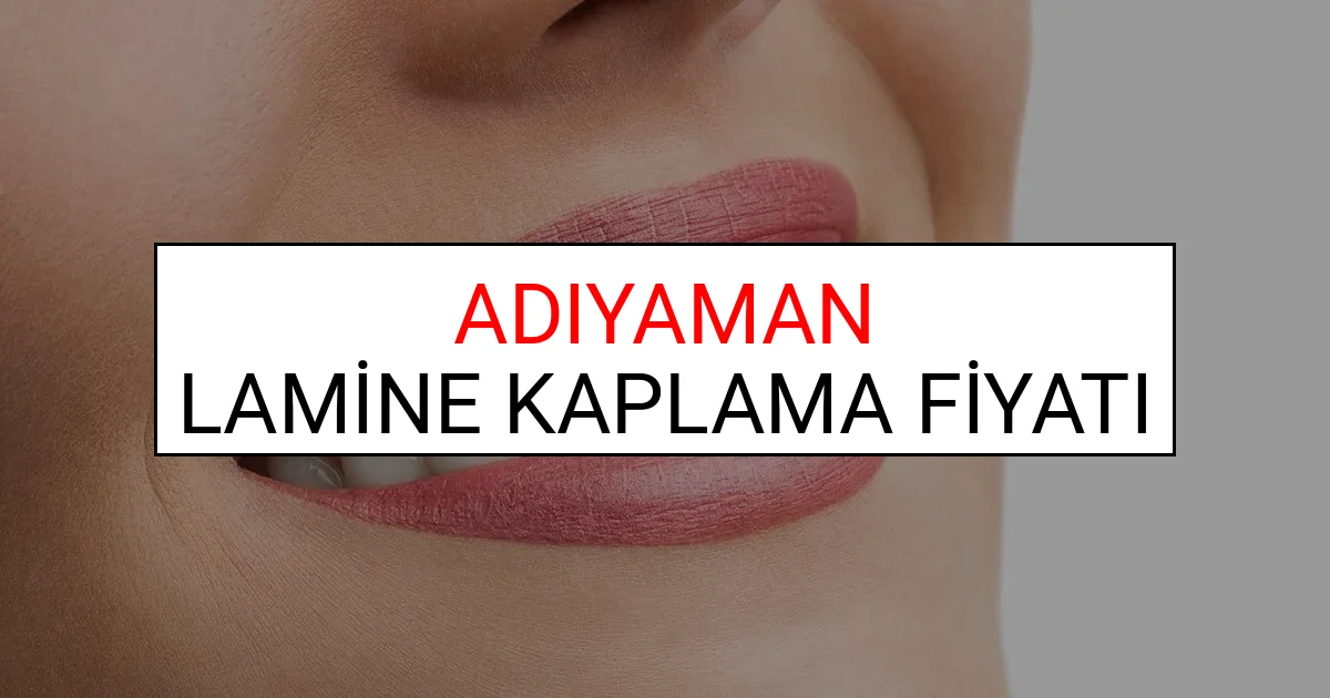 Adıyaman Lamine Diş Kaplama Fiyatları Ne Kadar? (2025 Adıyaman TDB Lamine Yaprak Diş Fiyatları)