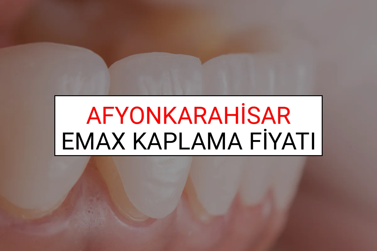 Afyonkarahisar Emax Diş Kaplama Fiyatları Ne Kadar? (2025 Afyonkarahisar TDB Emax Diş Fiyatları)