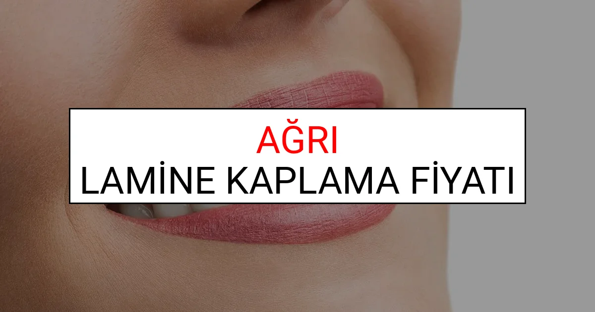 Ağrı Lamine Diş Kaplama Fiyatları Ne Kadar? (2025 Ağrı TDB Lamine Yaprak Diş Fiyatları)