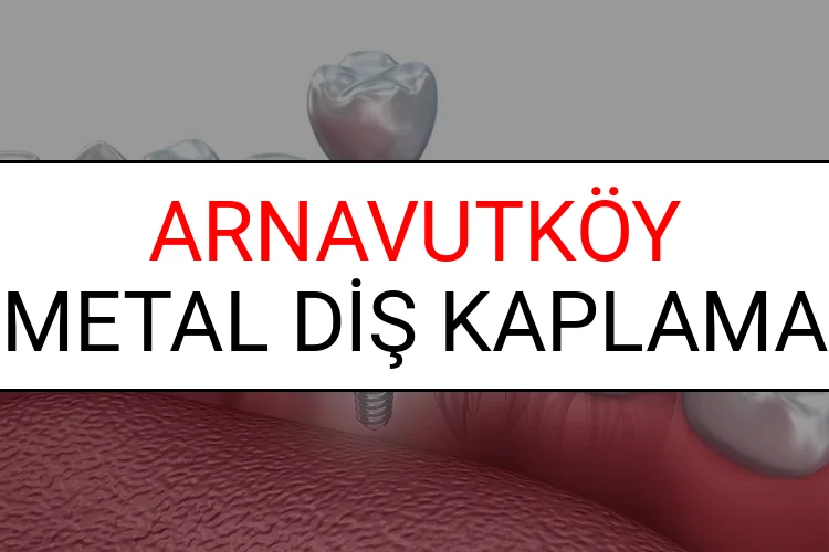 Arnavutköy Metal Diş Kaplama Fiyatları Ne Kadar? (2025 Arnavutköy TDB Metal Destekli Diş Fiyatları)