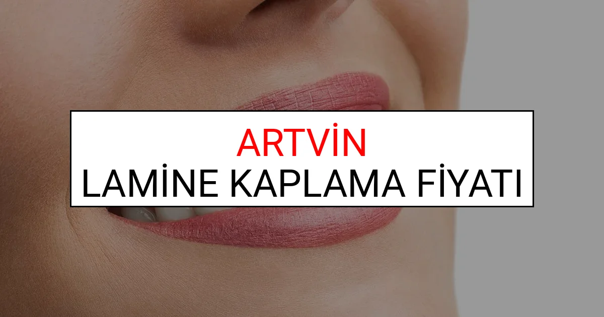 Artvin Lamine Diş Kaplama Fiyatları Ne Kadar? (2025 Artvin TDB Lamine Yaprak Diş Fiyatları)