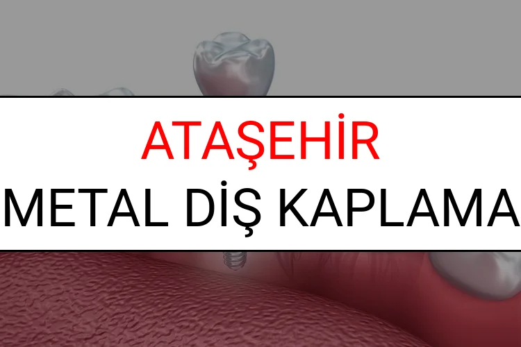 Ataşehir Metal Diş Kaplama Fiyatları Ne Kadar? (2025 Ataşehir TDB Metal Destekli Diş Fiyatları)