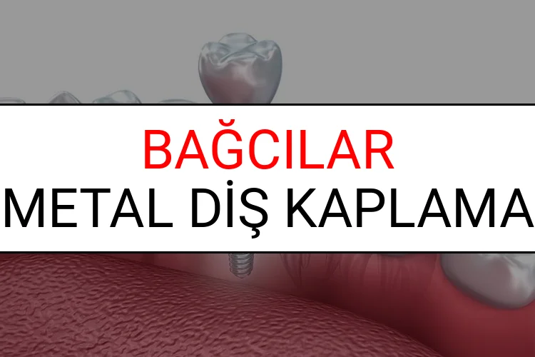 Bağcılar Metal Diş Kaplama Fiyatları Ne Kadar? (2025 Bağcılar TDB Metal Destekli Diş Fiyatları)