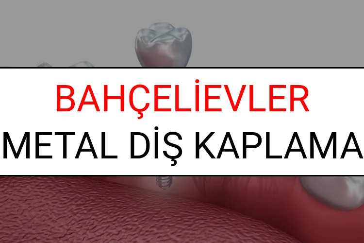 Bahçelievler Metal Diş Kaplama Fiyatları Ne Kadar? (2025 Bahçelievler TDB Metal Destekli Diş Fiyatları)