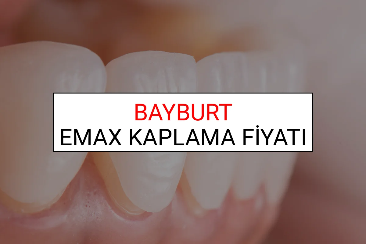 Bayburt Emax Diş Kaplama Fiyatları Ne Kadar? (2025 Bayburt TDB Emax Diş Fiyatları)