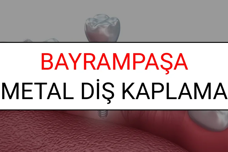 Bayrampaşa Metal Diş Kaplama Fiyatları Ne Kadar? (2025 Bayrampaşa TDB Metal Destekli Diş Fiyatları)