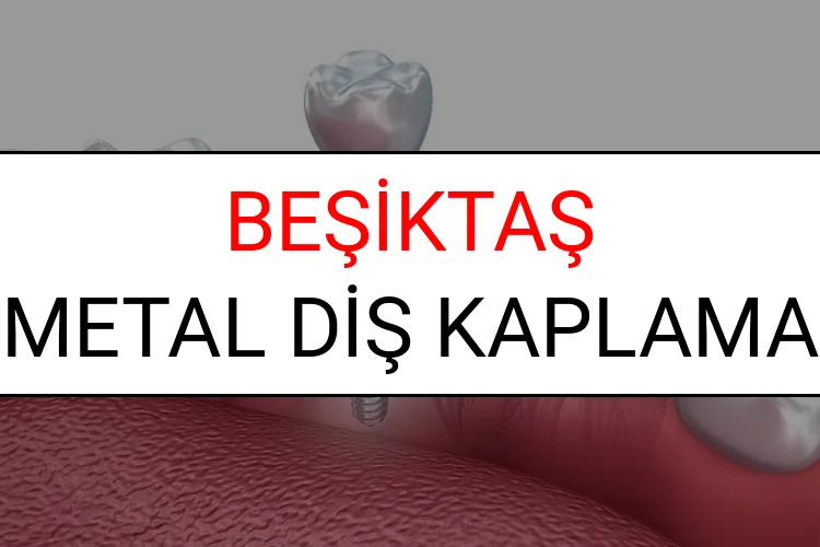 Beşiktaş Metal Diş Kaplama Fiyatları Ne Kadar? (2025 Beşiktaş TDB Metal Destekli Diş Fiyatları)