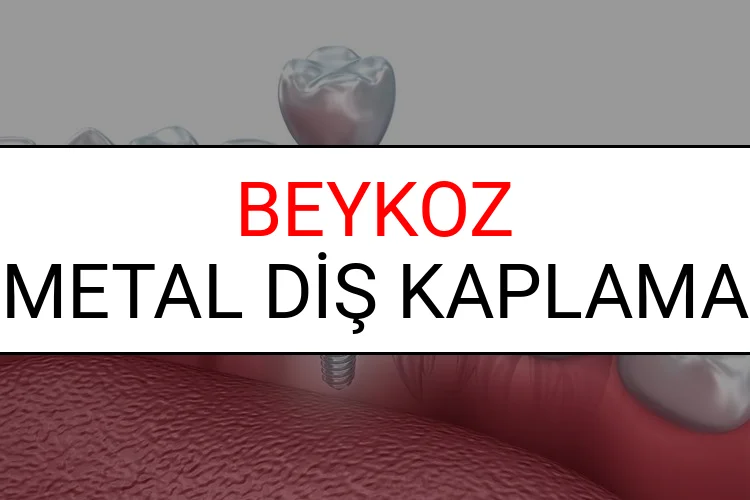 Beykoz Metal Diş Kaplama Fiyatları Ne Kadar? (2025 Beykoz TDB Metal Destekli Diş Fiyatları)