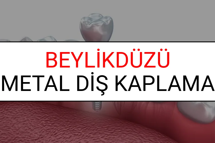 Beylikdüzü Metal Diş Kaplama Fiyatları Ne Kadar? (2025 Beylikdüzü TDB Metal Destekli Diş Fiyatları)
