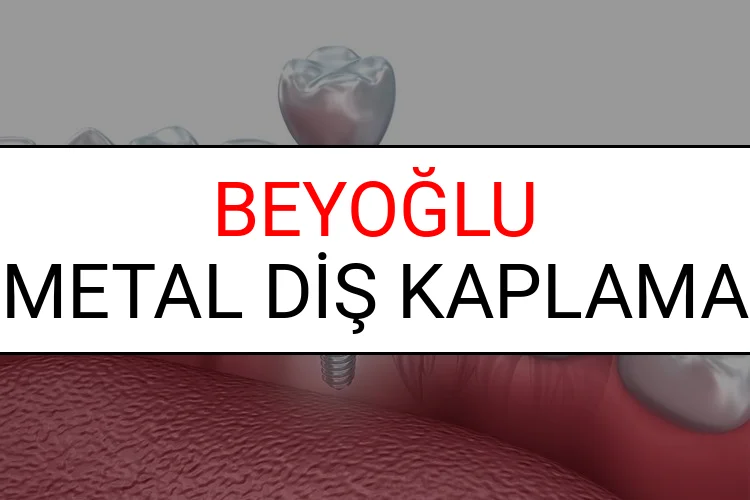 Beyoğlu Metal Diş Kaplama Fiyatları Ne Kadar? (2025 Beyoğlu TDB Metal Destekli Diş Fiyatları)