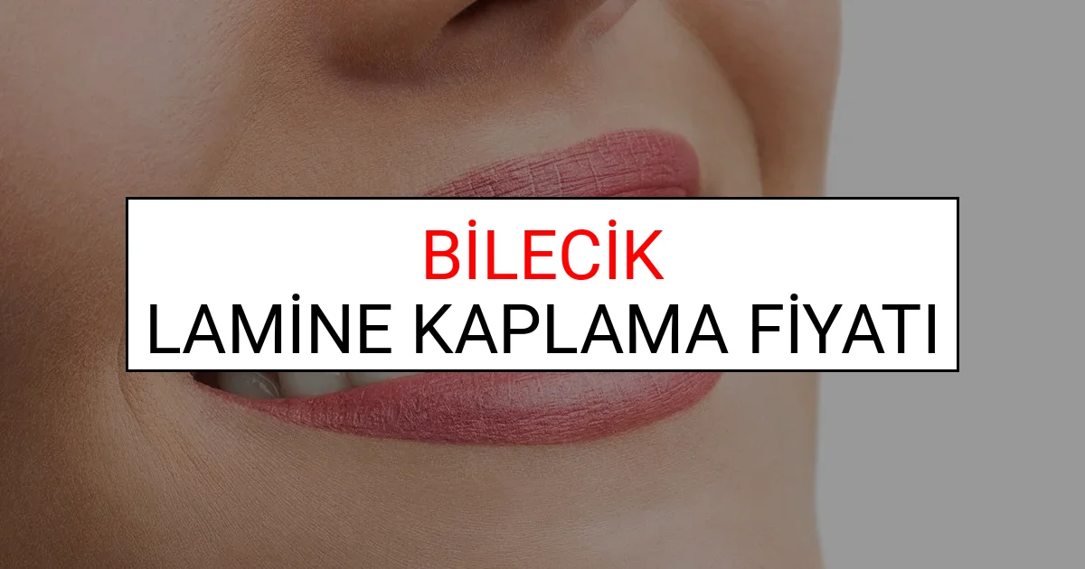 Bilecik Lamine Diş Kaplama Fiyatları Ne Kadar? (2025 Bilecik TDB Lamine Yaprak Diş Fiyatları)