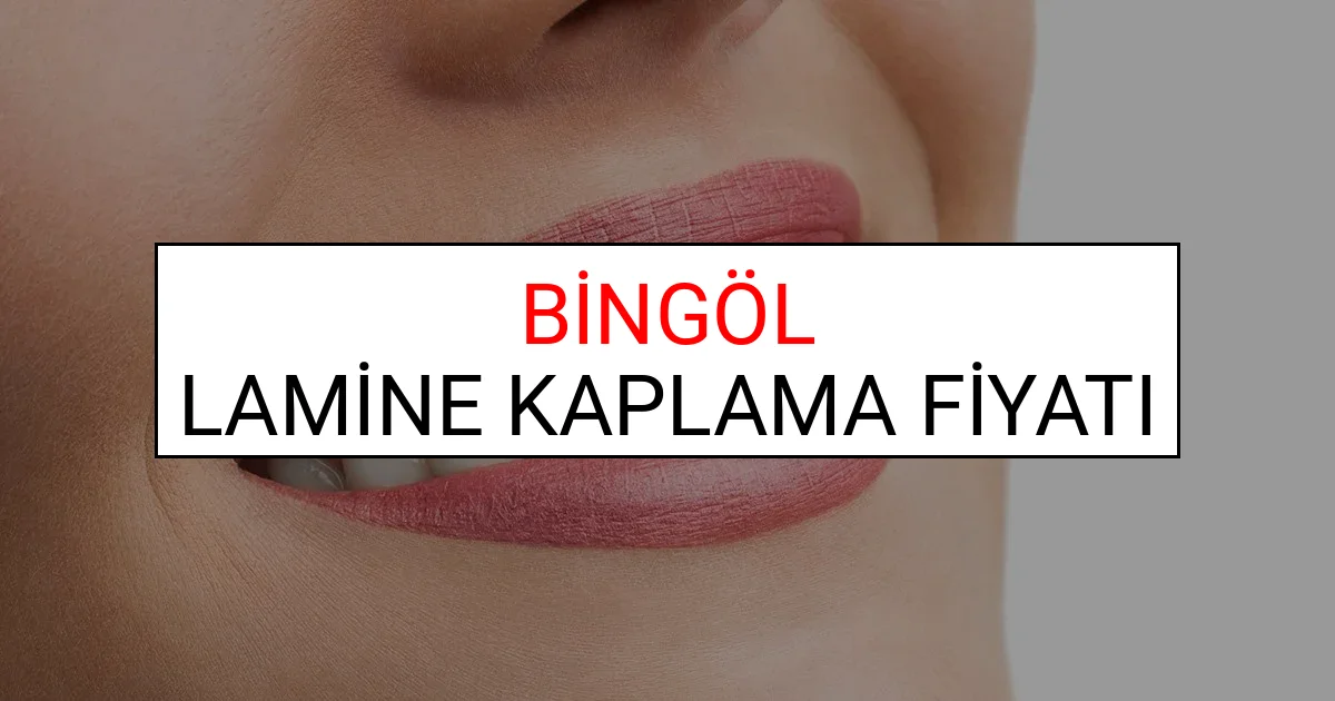 Bingöl Lamine Diş Kaplama Fiyatları Ne Kadar? (2025 Bingöl TDB Lamine Yaprak Diş Fiyatları)
