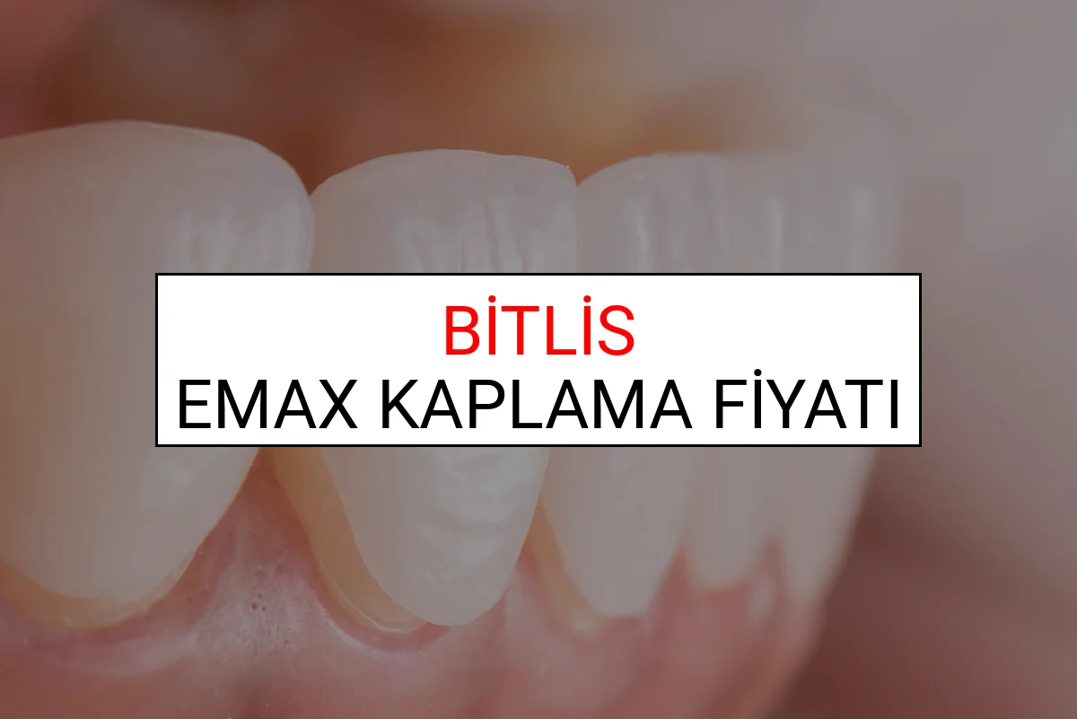 Bitlis Emax Diş Kaplama Fiyatları Ne Kadar? (2025 Bitlis TDB Emax Diş Fiyatları)