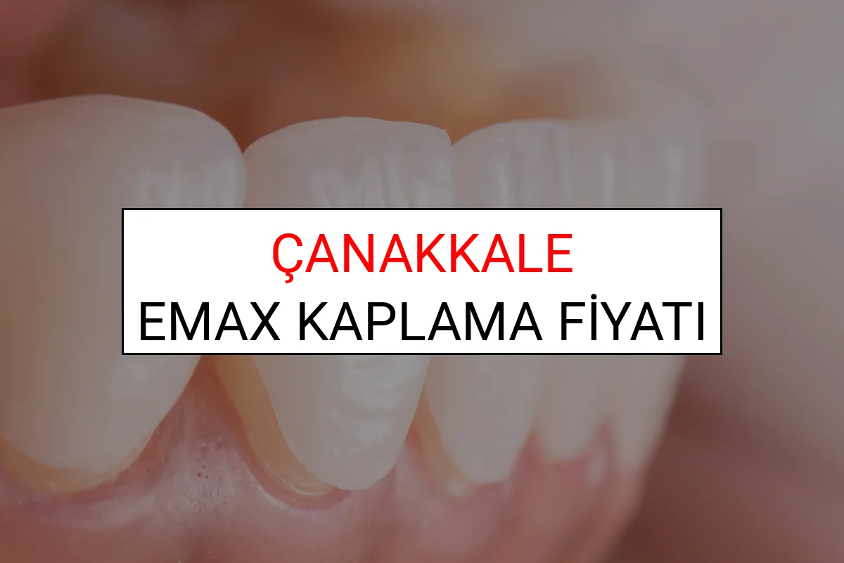 Çanakkale Emax Diş Kaplama Fiyatları Ne Kadar? (2025 Çanakkale TDB Emax Diş Fiyatları)