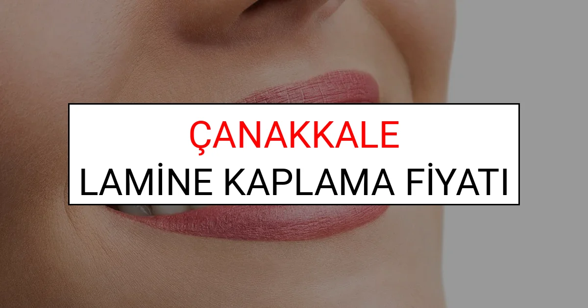 Çanakkale Lamine Diş Kaplama Fiyatları Ne Kadar? (2025 Çanakkale TDB Lamine Yaprak Diş Fiyatları)