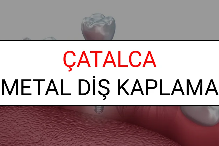 Çatalca Metal Diş Kaplama Fiyatları Ne Kadar? (2025 Çatalca TDB Metal Destekli Diş Fiyatları)