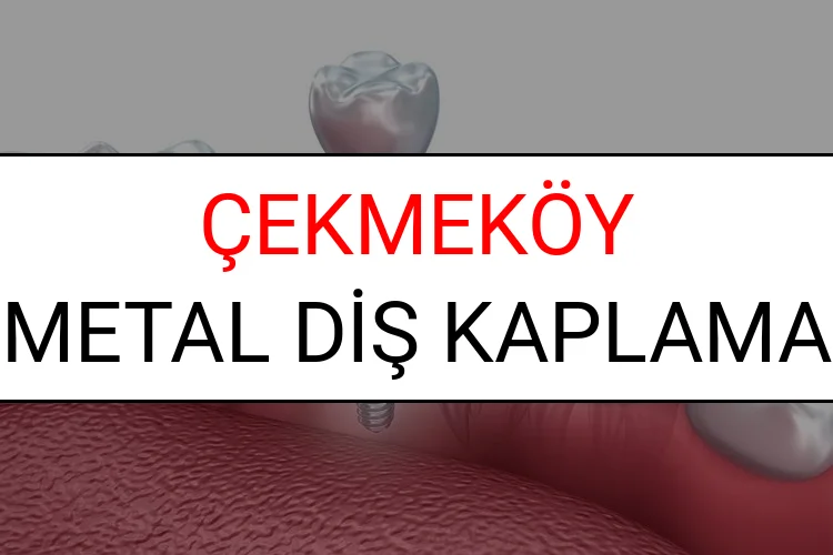 Çekmeköy Metal Diş Kaplama Fiyatları Ne Kadar? (2025 Çekmeköy TDB Metal Destekli Diş Fiyatları)