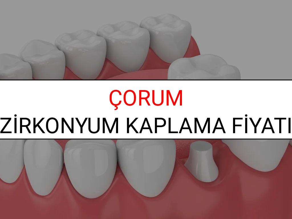 Çorum Zirkonyum Diş Kaplama Fiyatları Ne Kadar? (2025 Çorum TDB Zirkonyum Diş Fiyatları)