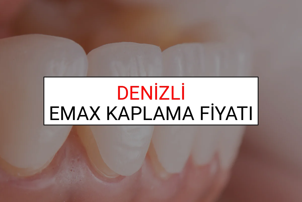 Denizli Emax Diş Kaplama Fiyatları Ne Kadar? (2025 Denizli TDB Emax Diş Fiyatları)