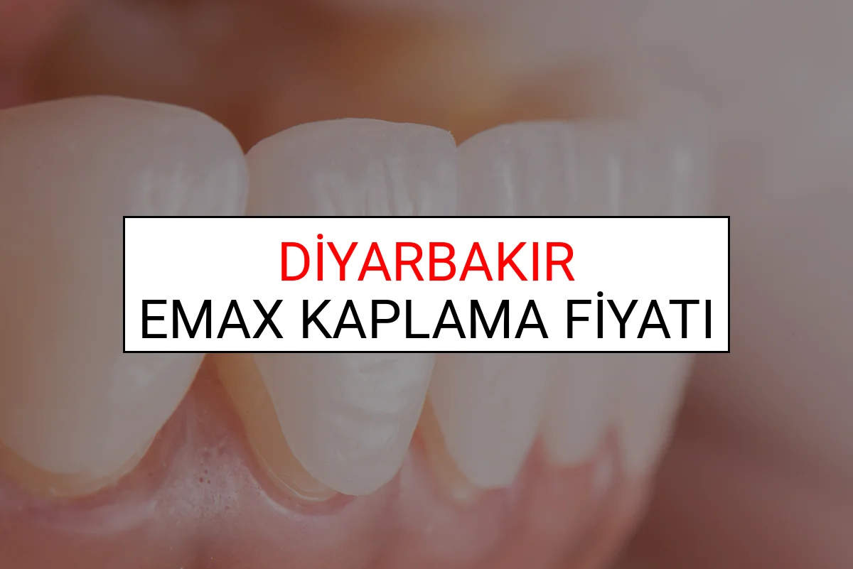 Diyarbakır Emax Diş Kaplama Fiyatları Ne Kadar? (2025 Diyarbakır TDB Emax Diş Fiyatları)