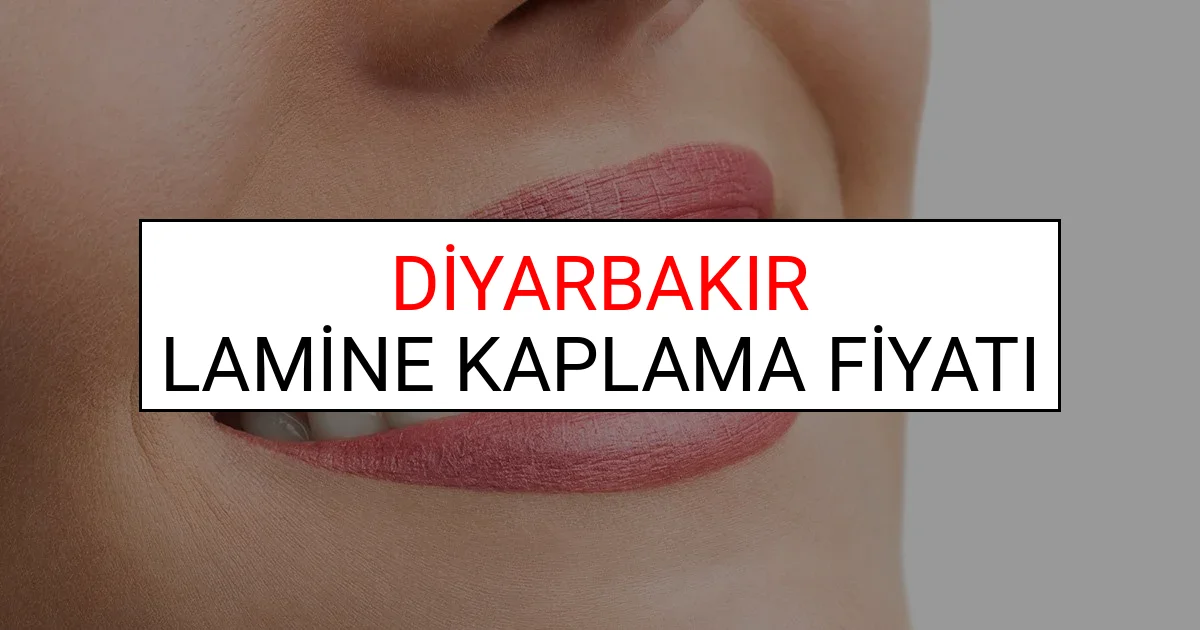 Diyarbakır Lamine Diş Kaplama Fiyatları Ne Kadar? (2025 Diyarbakır TDB Lamine Yaprak Diş Fiyatları)