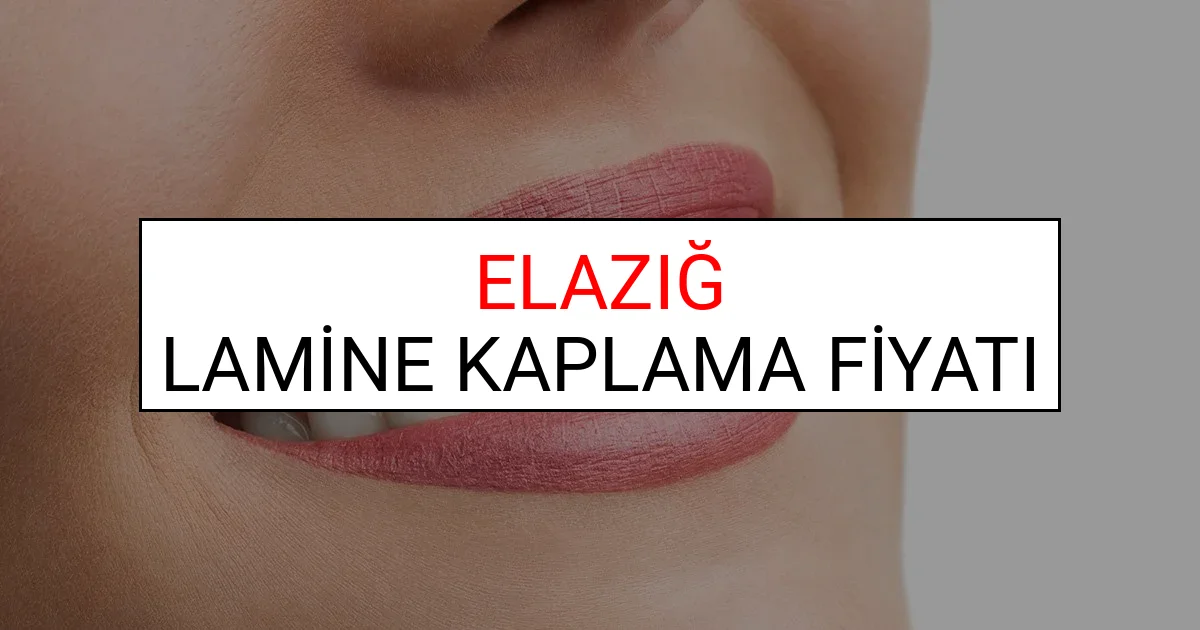 Elazığ Lamine Diş Kaplama Fiyatları Ne Kadar? (2025 Elazığ TDB Lamine Yaprak Diş Fiyatları)