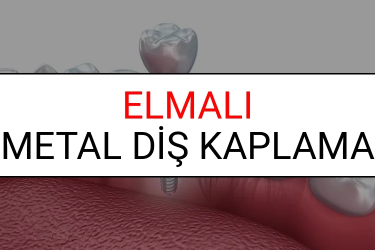 Elmalı Metal Diş Kaplama Fiyatları Ne Kadar? (2025 Elmalı TDB Metal Destekli Diş Fiyatları)